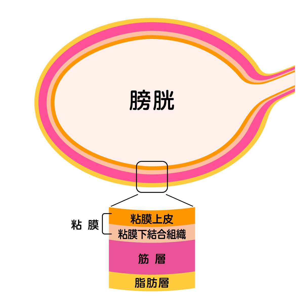 膀胱がんについて Sbi Pharma