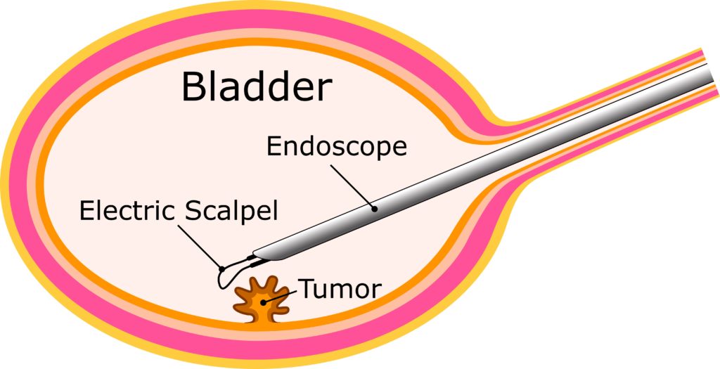 Graph3_English-1024x525.jpg